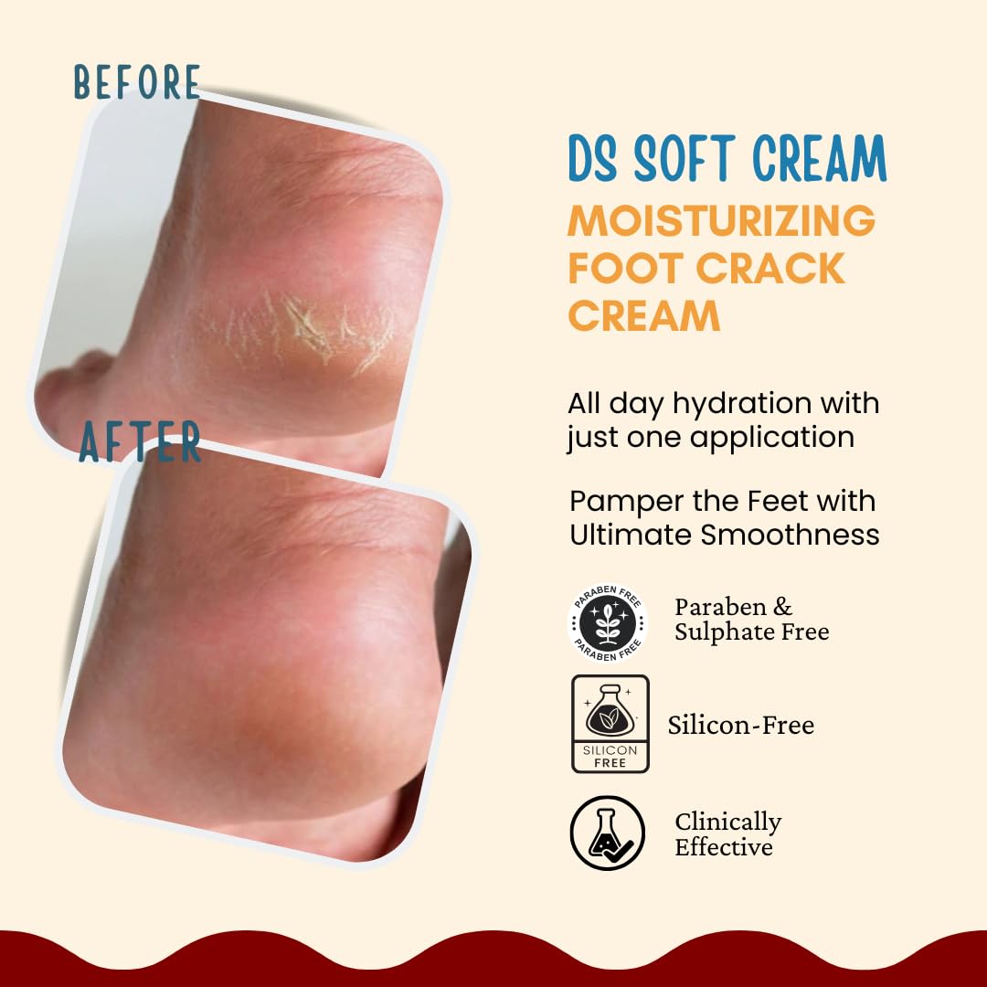 Adonis SOFT Cracked Heel Repair Cream for Soothing & Healing Cracked Heel | 100g